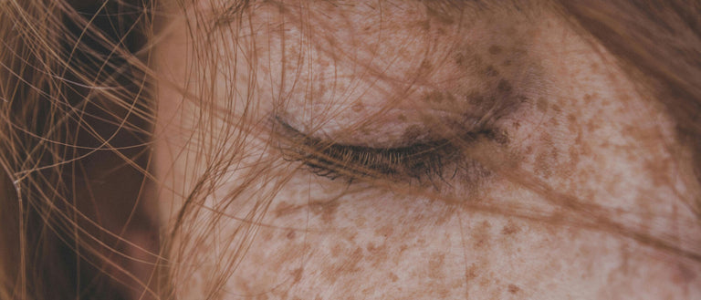 Geschlossenes Auge mit Sommersprossen – natürliche Ruhe und reine Hautpflege von Barnängen.